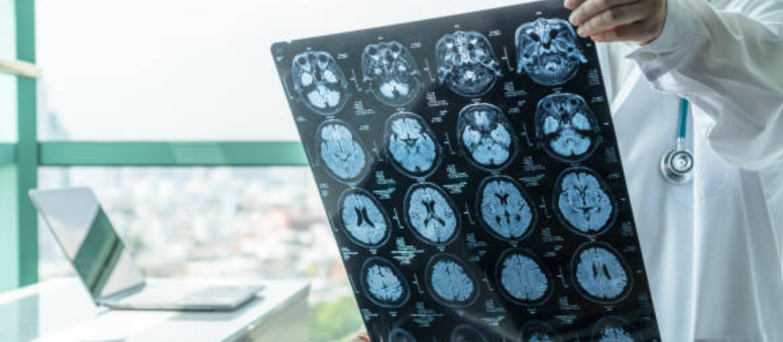 Banner neurosurgeon in Gautam Buddha Nagar